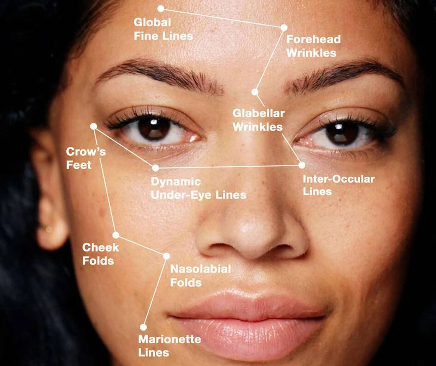 SkinCeuticals P-TIOX